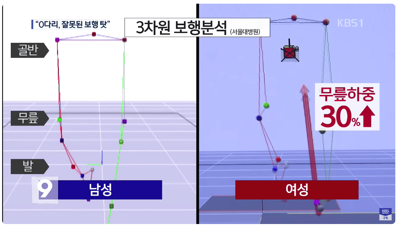 보행분석.png