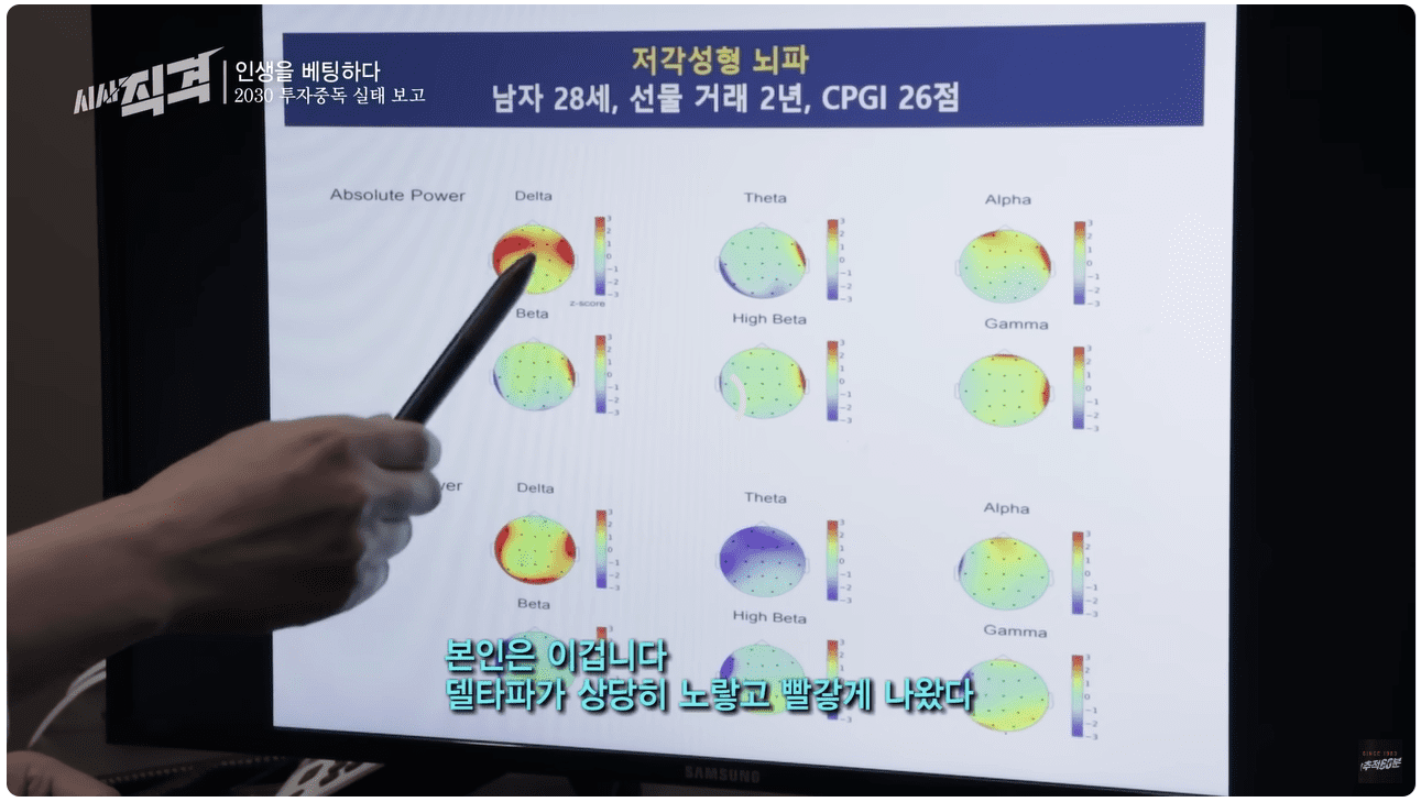 선물2년차의 뇌.png