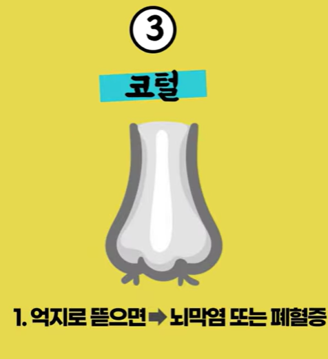 3코털.png