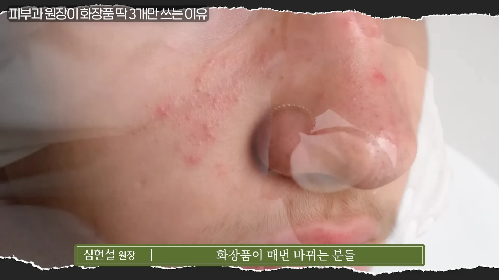 피부과 원장이 화장품 딱 ',3가지',만 사용하는 진짜 이유 _ 의사들의 수다 EP. 18 20-54 screenshot.webp
