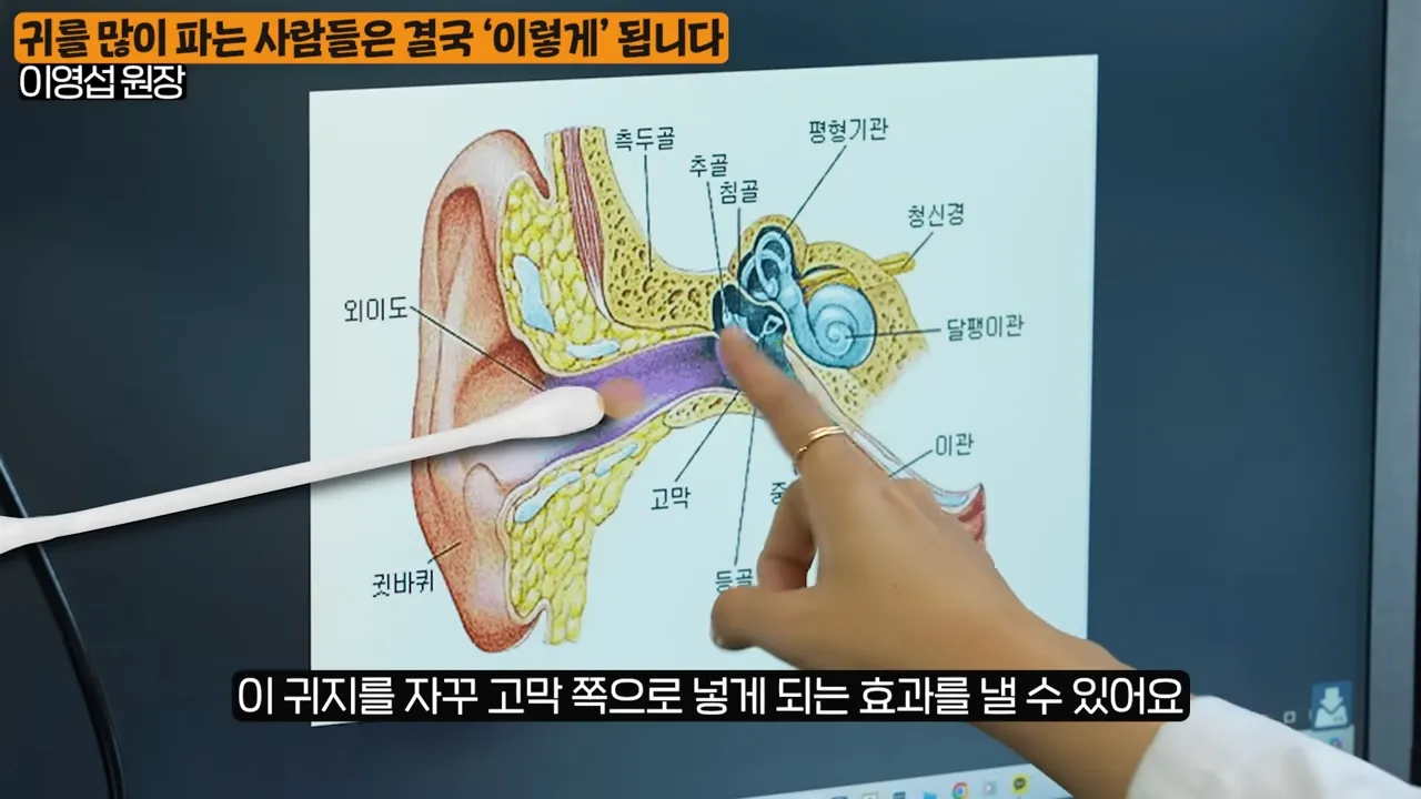 상상 못할 곳에 퍼진다_ 이비인후과 원장이 알려주는 귀를 파면 안되는 진짜 이유 (이영섭 원장 1부) 2-59 screenshot.webp