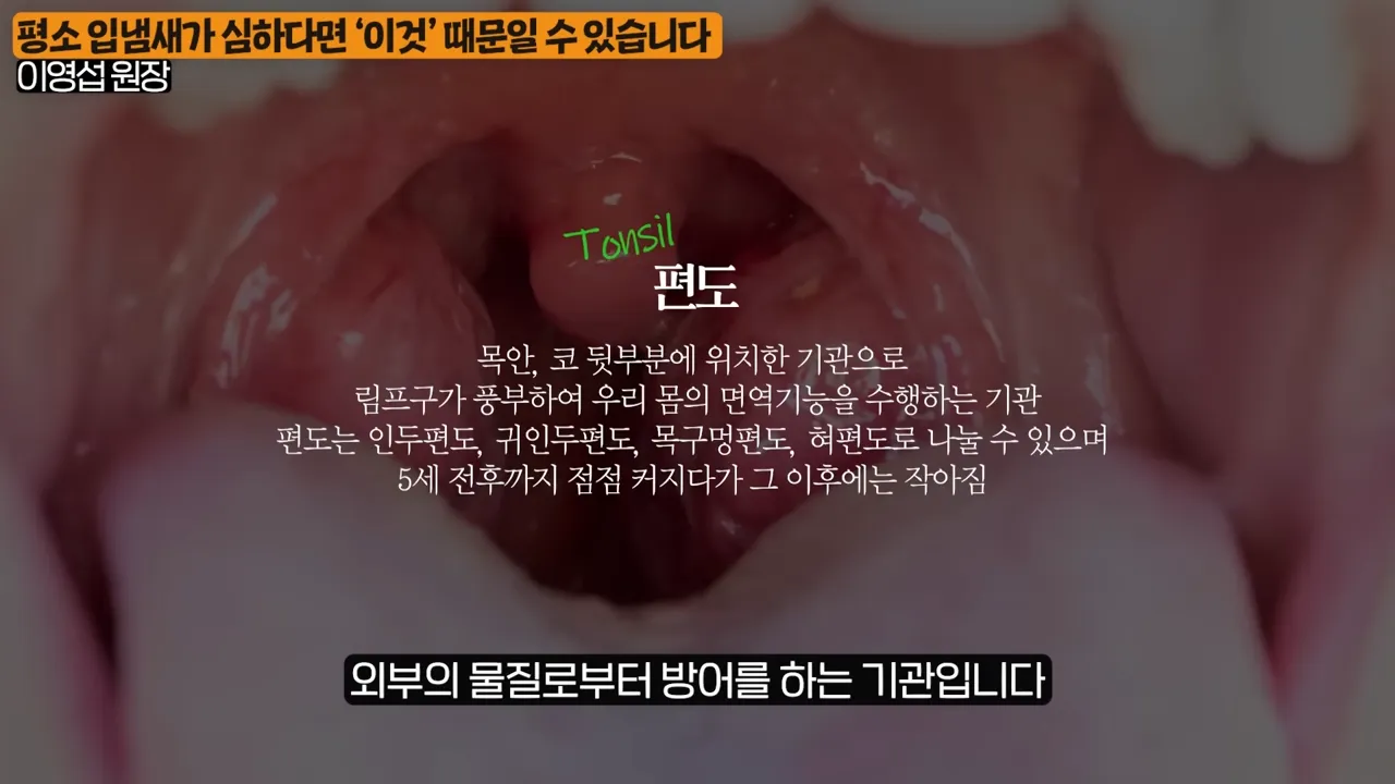 입냄새의 진짜 원인, 목에 낀 똥을 싹 없애는 간단한 방법 (이영섭 원장 2부) 0-48 screenshot.webp