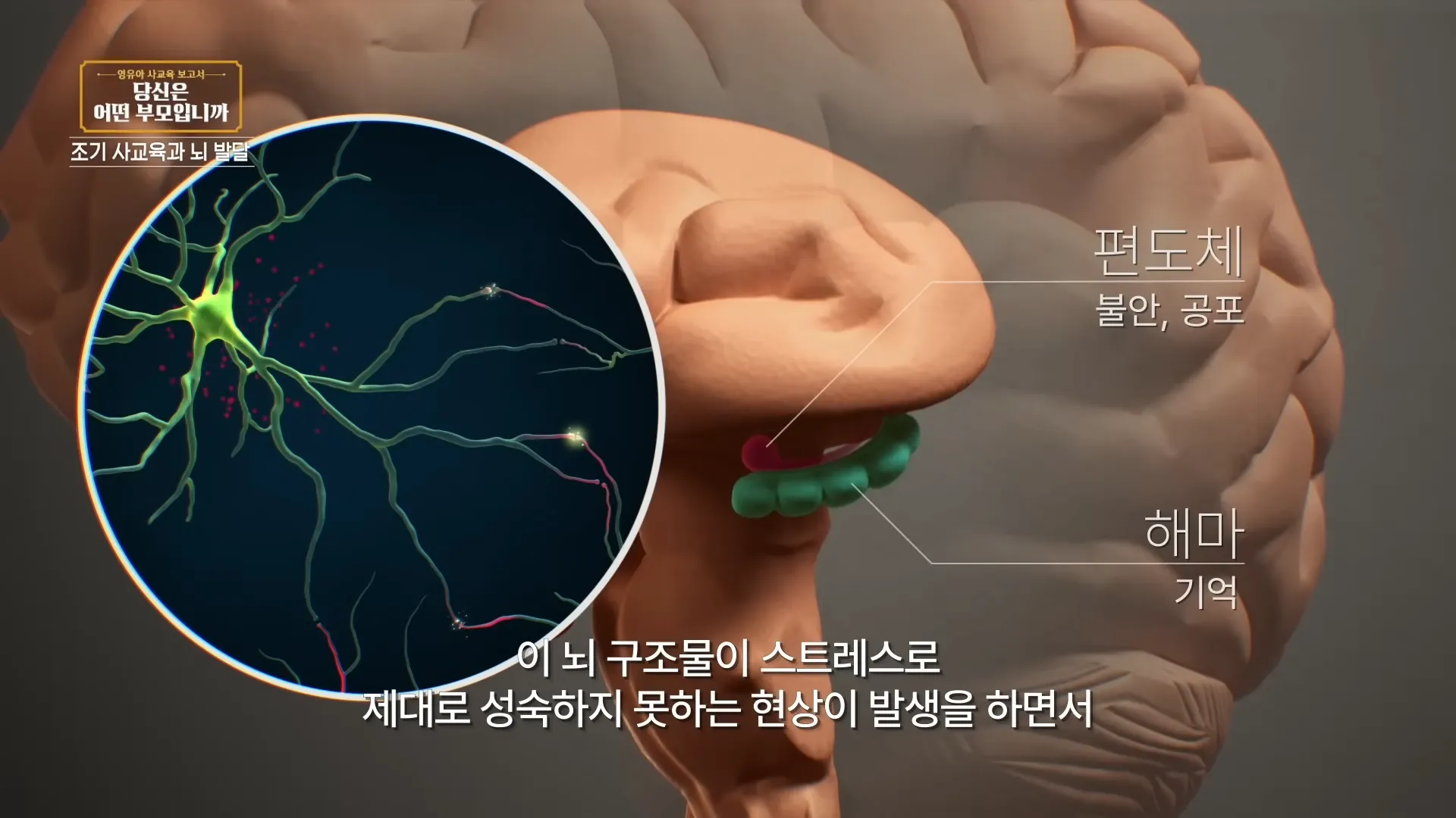 빨리 배운다는 것은 희생하는 게 있는 거예요_ 레벨테스트 통과만으로도 서울대 합격처럼 기뻐하는 부모, 내 아이의 뇌는 괜찮을까_🧠 _ 영유아 사교육 보고서 _ #교육다큐멘터리 15-10 screenshot.webp